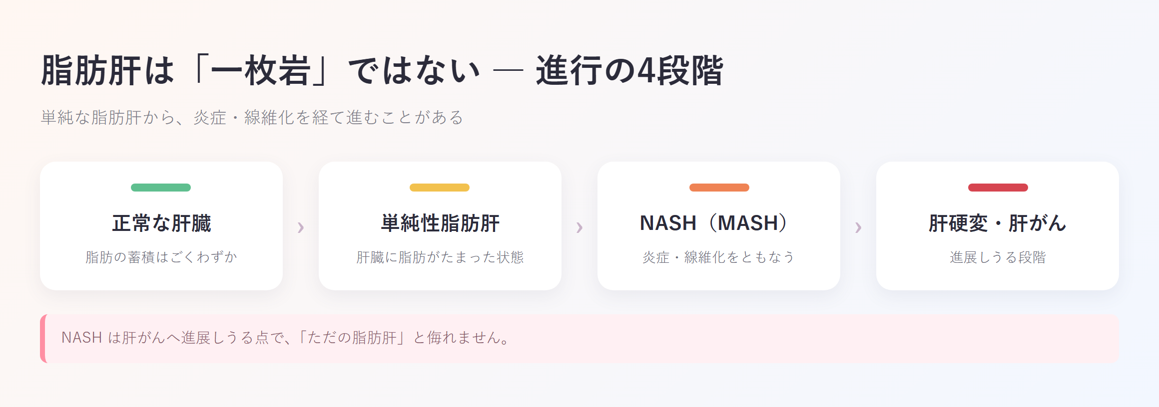 脂肪肝の進行段階:正常な肝臓→単純性脂肪肝→NASH(炎症・線維化)→肝硬変・肝がんの4段階を示す図解