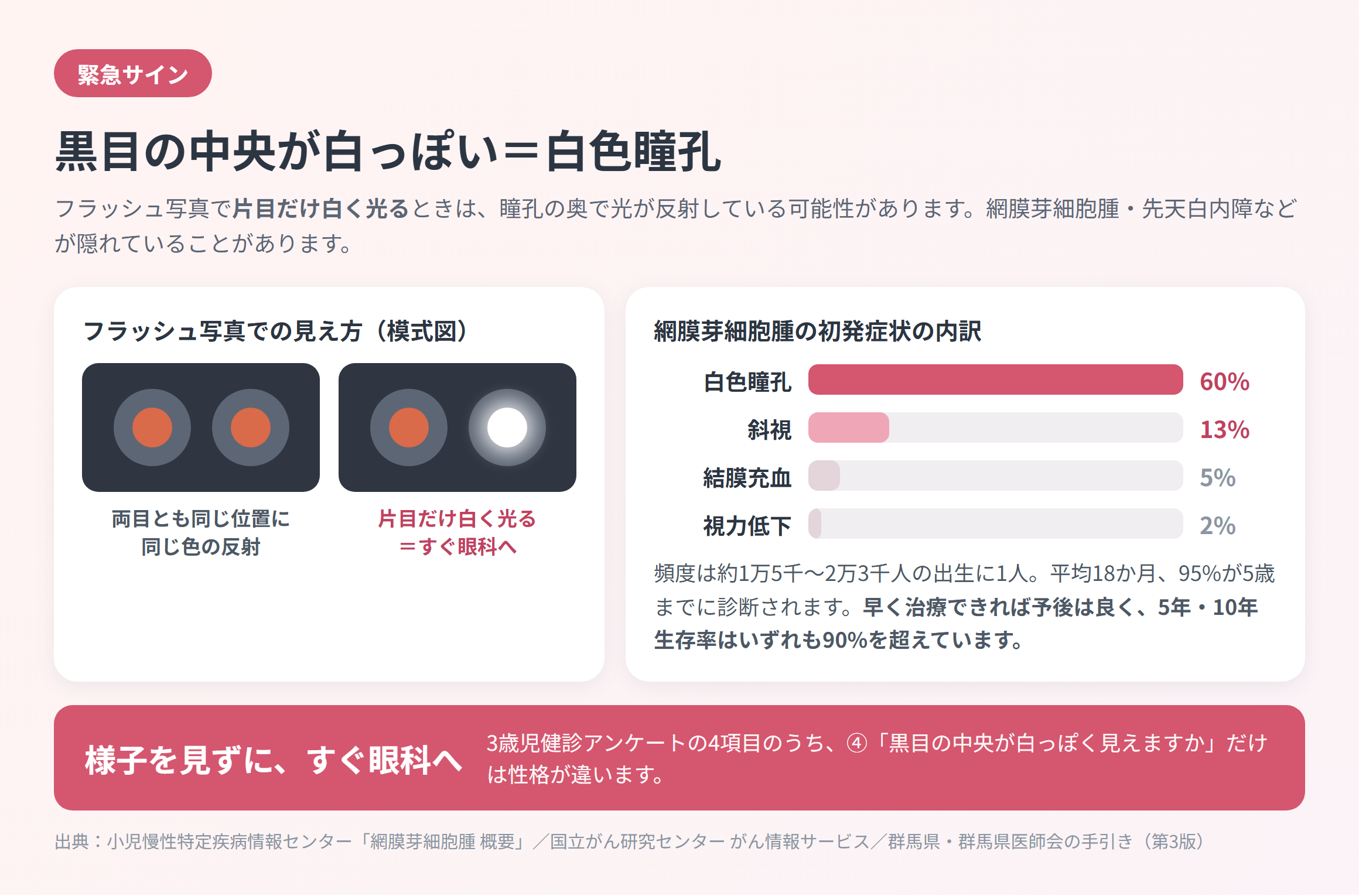 白色瞳孔の模式図。フラッシュ写真で片目だけ白く光る例と、網膜芽細胞腫の初発症状の内訳（白色瞳孔60%・斜視13%）