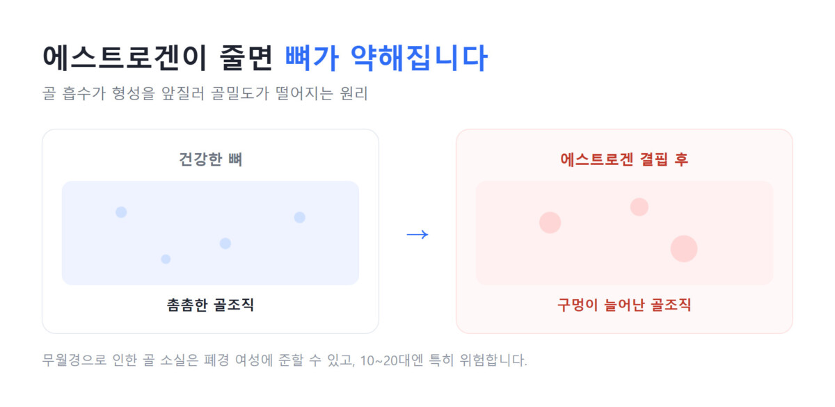 에스트로겐 저하에 따른 골밀도 감소 비교 도식