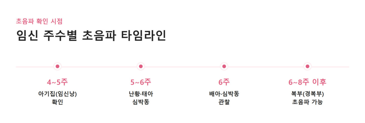 임신 주수별 초음파 확인 시점(4~5주 아기집, 5~6주 난황·심박동, 6주 배아, 6~8주 이후 복부 초음파)을 나타낸 타임라인