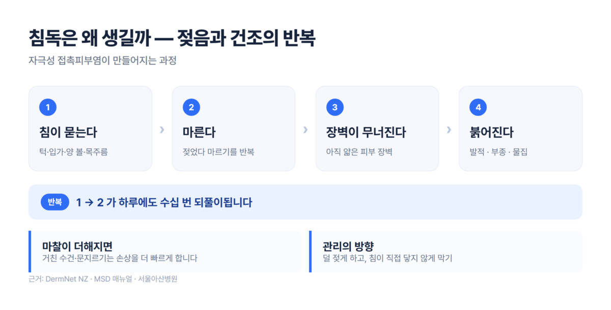 침이 묻고 마르기를 반복하며 피부 장벽이 무너져 붉어지는 4단계 과정을 정리한 다이어그램