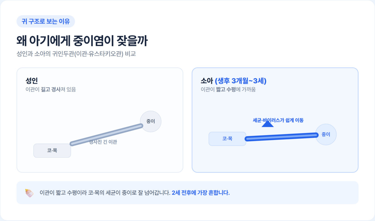 성인과 소아의 귀인두관(이관) 각도·길이를 비교한 다이어그램