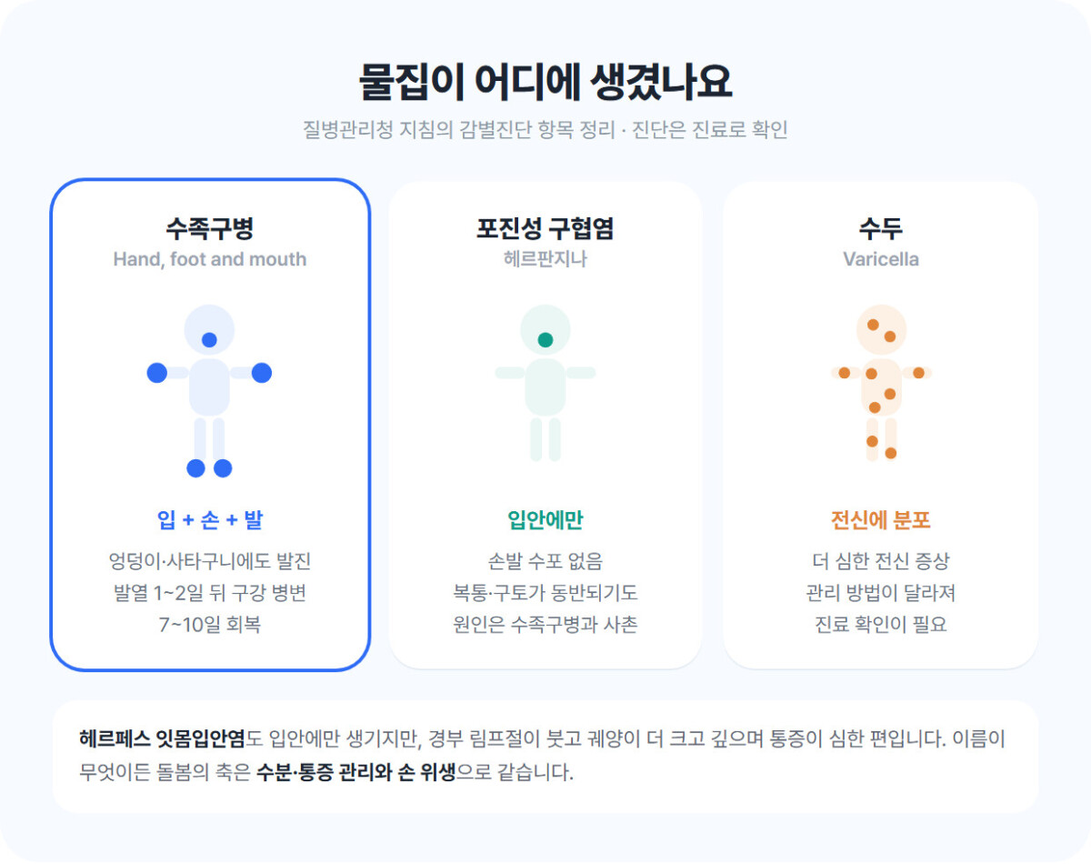 수족구병·헤르판지나·수두의 물집 발생 부위를 아이 실루엣 도식으로 비교한 인포그래픽