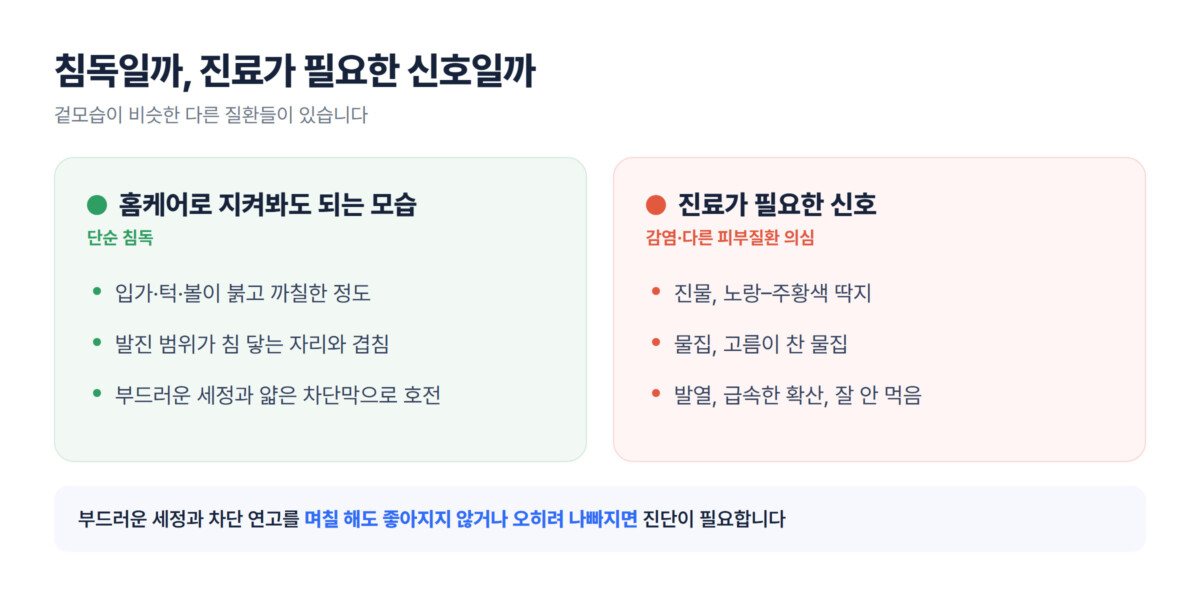 홈케어로 지켜봐도 되는 모습과 진료가 필요한 신호를 좌우로 나눈 신호등형 비교 그래픽