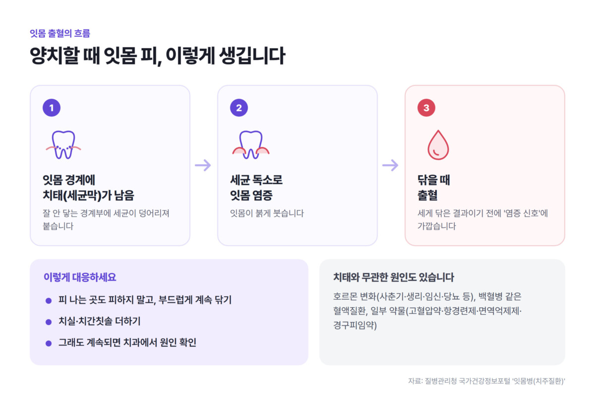 잇몸 경계에 남은 치태가 염증을 일으켜 닦을 때 출혈로 이어지는 3단계 흐름과 대응법, 치태와 무관한 출혈 원인을 정리한 인포그래픽
