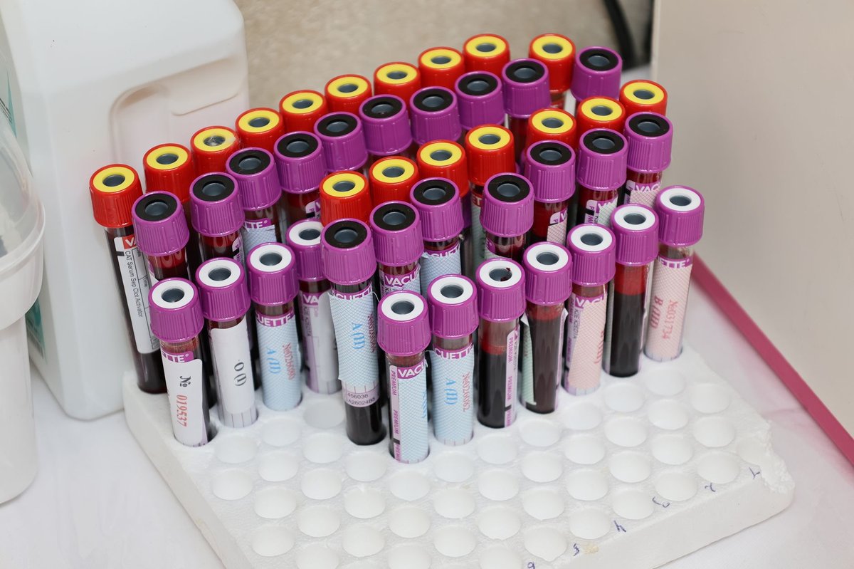 Rows of blood sample vials in a laboratory rack, ready for a ferritin and hemoglobin test