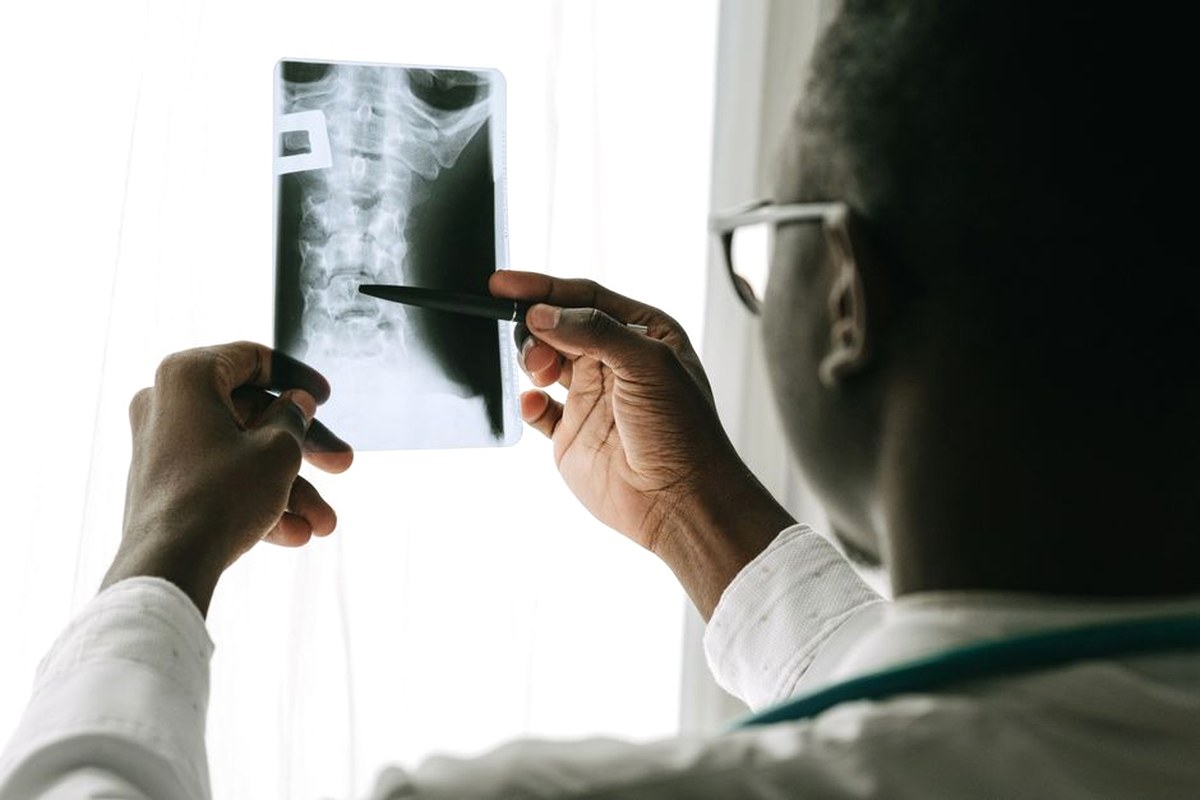 A clinician in a white coat holding a spine X-ray film up to a bright window and pointing at a vertebra with a pen.
